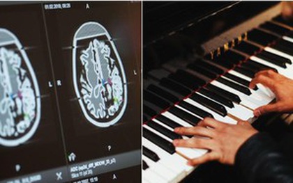 Nhạc sĩ chơi đàn piano khi đang được phẫu thuật não