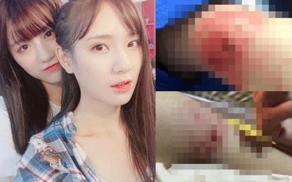 Biến căng: Idol girlgroup ngầm tố cáo bị thành viên cùng nhóm đánh đập dã man, cả 2 từng là cặp đôi siêu hot