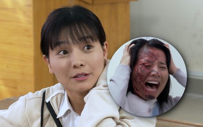 Pha đánh ghen kinh hoàng ở "Hoa Cúc Vàng Trong Bão": Nữ chính xinh đẹp bị tạt axit cháy nát mặt