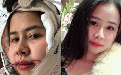 Bị chồng bỏ vì xấu, bị cô gái trẻ đẹp nói 1 câu cay nghiệt, người phụ nữ chấp nhận đau đớn để thay đổi