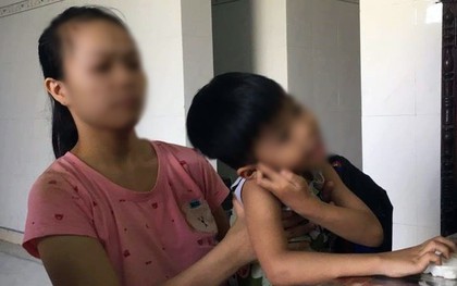 Phụ huynh ở Quảng Nam tố con bị cô giáo mầm non đánh chấn động não