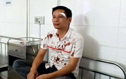Chậm đóng tiền bát họ, nam thanh niên bị đánh nhập viện