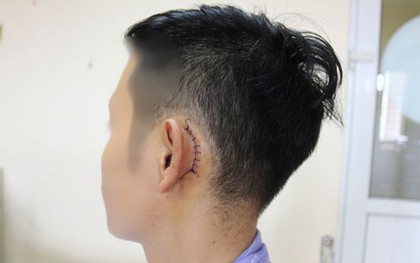 Sạc điện thoại bên gối, nam thanh niên thủng màng nhĩ