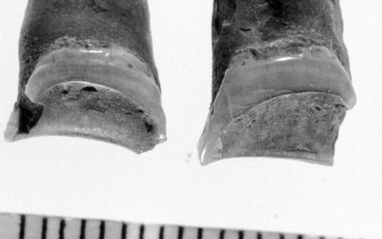 Từ một cái răng 4000 năm tuổi, khoa học giải quyết được câu hỏi khó nhất trong ngành khảo cổ: người chết đã từng làm nghề gì?