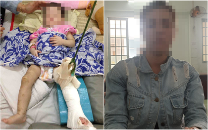 TPHCM: "Mẹ nuôi" bạo hành con gái 1 tuổi đến gãy chân, thương tích gần 60%