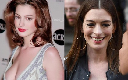 Từng gây sốt vì đẹp "ná thở", mỹ nhân ngực khủng Anne Hathaway lộ gương mặt nhăn nheo đến mức khó lòng nhận ra