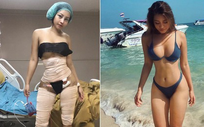 Hot girl bốc lửa Thái Lan bất ngờ công khai ảnh phẫu thuật để có eo con kiến, điều đáng nói đây không phải lần đầu cô lột xác
