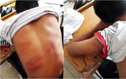Phẫn nộ hình ảnh học sinh lớp 8 bị bố đánh “bầm dập” ngất xỉu tại lớp, nhà trường phải đưa đi cấp cứu