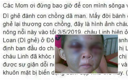 Thực hư thông tin bé trai ở Thanh Hóa bị dì ghẻ đánh đập thâm tím mặt vì… nhớ mẹ