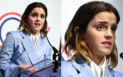 Ảnh không photoshop bóc mẽ làn da sần sùi, nhăn nheo vì lão hóa quá nhanh của Emma Watson trước tuổi 30