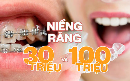 Niềng răng 30 triệu với 100 triệu: khác biệt thế nào, có phải càng đắt càng hiệu quả?