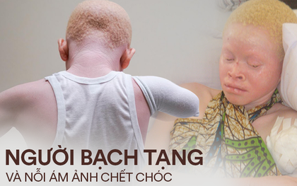 Nỗi bất hạnh của người bạch tạng ở lục địa đen: Bị săn lùng như động vật quý hiếm, đến trẻ nhỏ cũng bị cắt cụt tứ chi vì cuồng tín mê muội