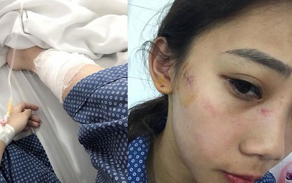 Hà Nội: 2 cô gái trẻ bị nhóm thanh niên trêu ghẹo, hành hung phải nhập viện