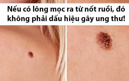 Giải mã 5 hiểu lầm cực phổ biến về ung thư có thể khiến cuộc sống của bạn chìm trong lo sợ