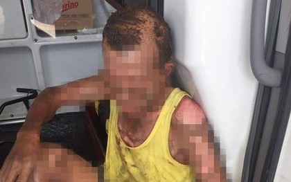 Nam Định: Con trai tưới xăng châm lửa đốt khiến bản thân tử vong, bố nhập viện cấp cứu
