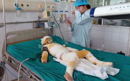 Vụ cô giáo đốt cồn dạy phòng chống cháy nổ: Nghẹn ngào lời kể của người mẹ trẻ