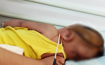 Long An: Bé gái 8 tháng tuổi nghi bị xuất huyết não ngay ngày đầu tiên được mẹ gửi đi nhà trẻ