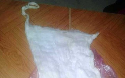 Xác minh thông tin bác sĩ bỏ quên băng gạc trong bụng sản phụ