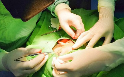 Đùa nghịch cùng bạn học, bé trai bị ngòi bút chì đâm vào mắt