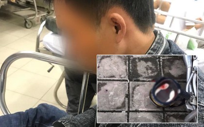 Thanh niên lái xe vi phạm lao với tốc độ cao, tông CSGT ở Sài Gòn nhập viện cấp cứu