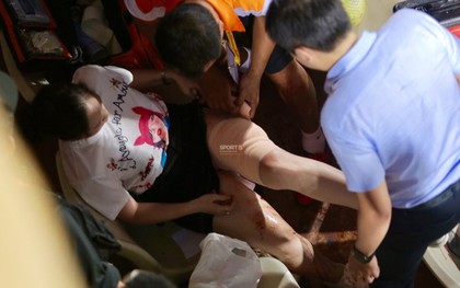 Vụ cổ động viên nữ trọng thương do trúng pháo sáng: Công an triệu tập 14 người quê ở Nam Định để điều tra