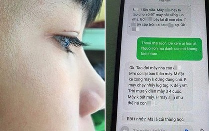 TP.HCM: Tài xế xe ôm công nghệ nghi hành hung học sinh lớp 9 dẫn đến chấn thương vì đứng sai điểm đón