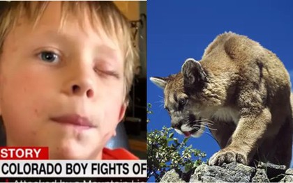 Sống sót thần kỳ sau khi bị báo sư tử tấn công, cậu bé 8 tuổi chia sẻ cách tự vệ khiến ai nấy đều bất ngờ