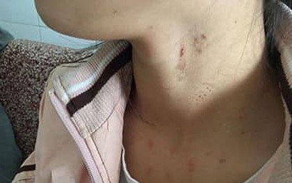 Người phụ nữ trình báo con gái học lớp 10 bị kẻ lạ mặt cưỡng bức