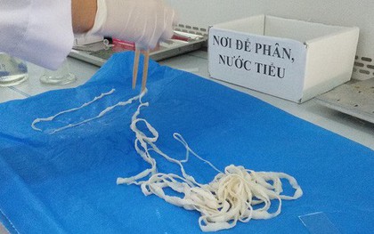 "Bắt" sán dây dài hơn 5 m khỏi cơ thể nữ giáo viên