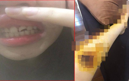 Người phụ nữ tố bị kẻ biến thái cố ý va chạm giao thông, sờ vào vùng kín rồi bỏ trốn khi bị chống cự