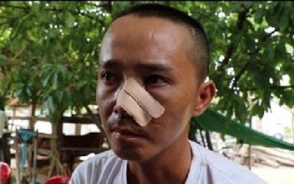 Ba cha con bị 20 người truy sát: Nạn nhân phẫn uất kể 3 trận đánh trong một buổi chiều