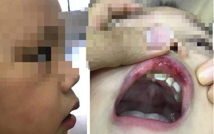 Lá thư xin lỗi gửi lúc đêm muộn của cô giáo ở Hà Nội tát bé hơn 2 tuổi sấp mặt