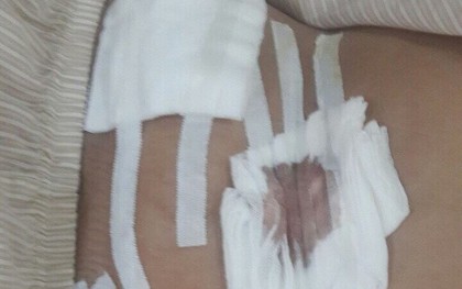 Được đặc cách, nữ thí sinh vừa mổ ruột thừa vẫn quyết tâm dự thi THPT Quốc gia