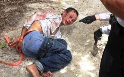 Chủ tiệm cầm đồ bị cứa cổ khi tranh cãi số tiền 100.000 đồng