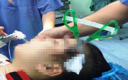 Nghệ An: Bị kéo nhọn găm vào đầu 3cm, bé gái 10 tuổi nhập viện nguy kịch