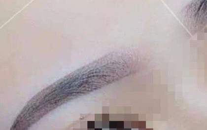 Người phụ nữ hôn mê sau xăm chân mày ở TP HCM đã tử vong
