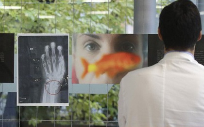 Triển lãm ảnh chụp X-quang về vấn nạn bạo lực gia đình tại Italy