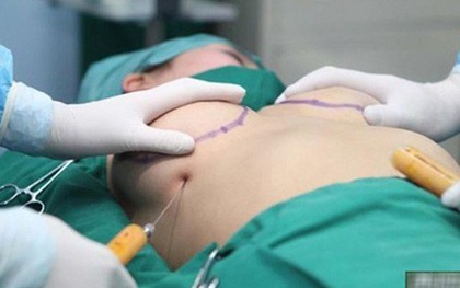 Cô gái trẻ ở TP HCM bị vỡ 2 túi độn ngực cùng lúc