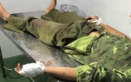 Hơn 20 lâm tặc vây chém đứt gân tay kiểm lâm để giải cứu đồng bọn