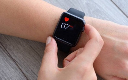 Apple Watch bị bác sĩ kiện vì “ăn cắp” bằng sáng chế phát hiện nhịp tim - tính năng làm nên thương hiệu của mình
