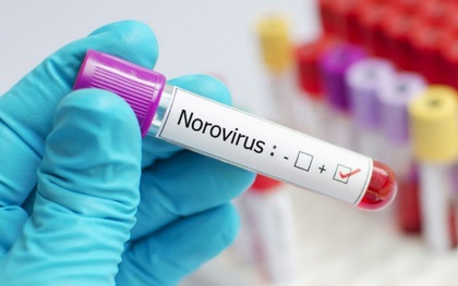 Trung Quốc: Hơn 70 sinh viên nghi nhiễm norovirus