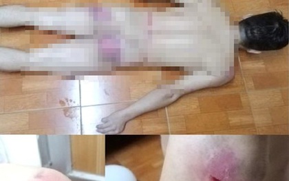 Vay nặng lãi, con nợ bị côn đồ đưa về trụ sở công ty rồi đánh đập dã man