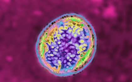 Hơn 6.600 người ở Trung Quốc mắc bệnh Brucellosis