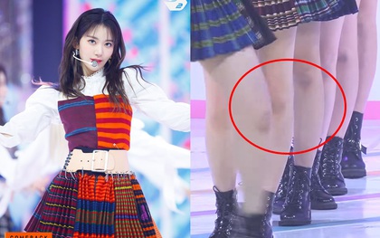 IZ*ONE lộ đầu gối bầm dập đầy thương tích trong sân khấu comeback, fan xót xa vì vũ đạo quá “khoai” mà lại không có đồ bảo hộ
