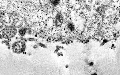 Phát hiện 3 biến chủng của virus SARS-CoV-2 trên thế giới