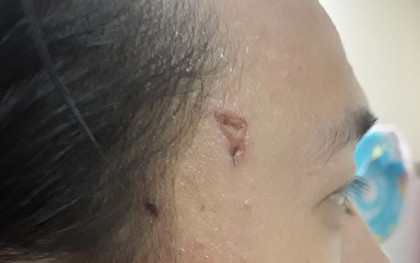 Chưởng môn võ Việt bóc mẽ bí mật ẩn sau màn công phu khoan vào thái dương, yết hầu