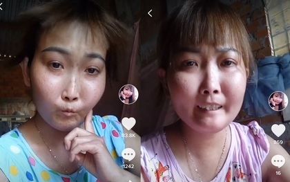 Cô gái Bến Tre mắc bệnh xơ cứng bì quay clip tiktok hút 2 triệu view: Gia cảnh khó khăn, bị trêu chọc vì gương mặt kì lạ
