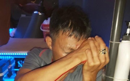 Bình Định: Tranh giành khách, một phụ xe bị bắn thủng mắt