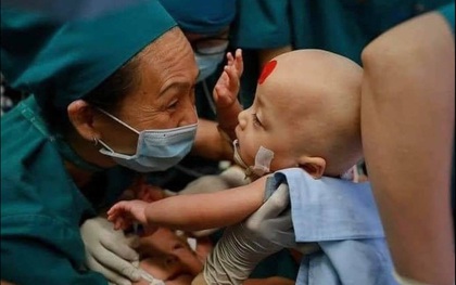 Cộng đồng mạng vỡ oà niềm vui khi ca phẫu thuật tách dính 2 bé song sinh thành công kỳ diệu: "Mong 2 con mọi điều tốt lành"