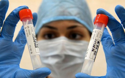 Nga sẽ sản xuất vaccine ngừa Covid-19 vào tháng 11